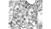 an electron microscope view of the virus that caused COVID. a circular area dotted with round spots